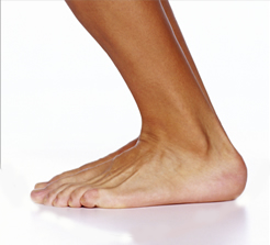 plantar fasciitis